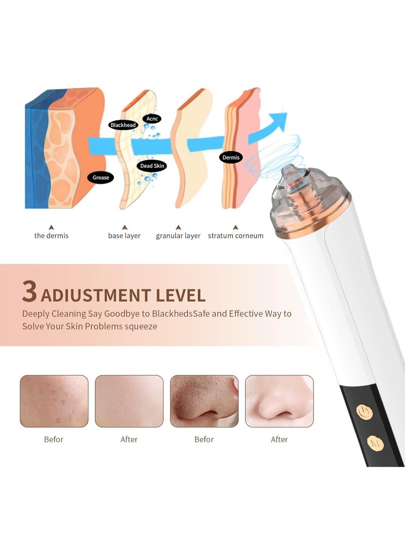 general Blackhead Remover Pore Vacuum,Facial Pore Cleaner-6 Suction Power,3 Adjustable Suction Levels,USB Rechargeable Blackhead Vacuum Kit Electric Acne Extractor Tool for Women & Men (White) - Image 3